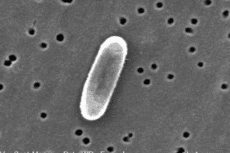 Bacteria Ralstonia mannitolilytica en hospitales de Costa Rica